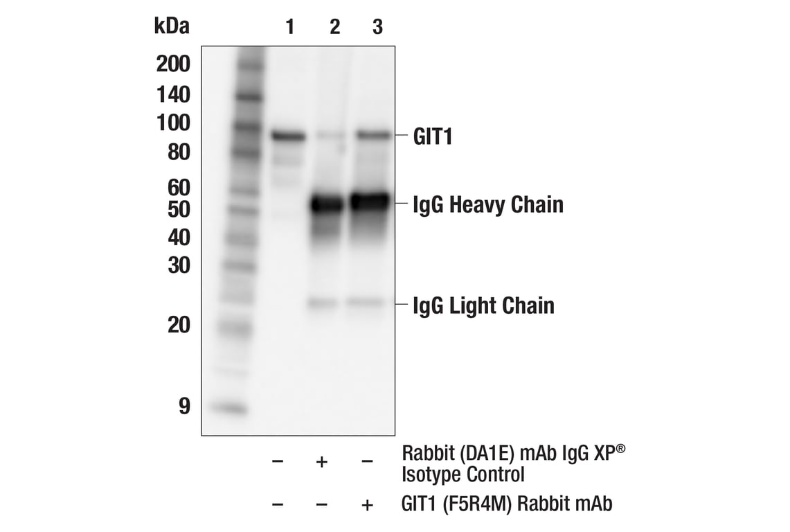 Immunoprecipitation Image 1: GIT1 (F5R4M) Rabbit Monoclonal Antibody
