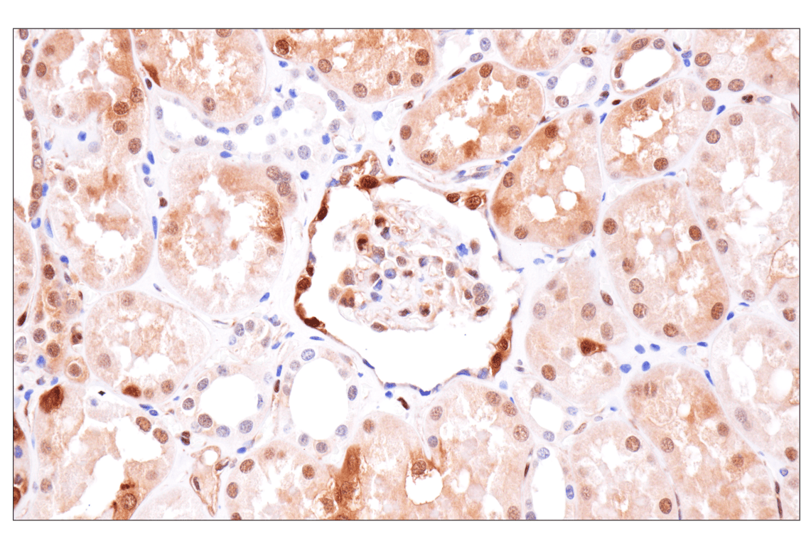 Immunohistochemistry Image 6: Phospho-ATP-Citrate Lyase (Ser455) (F4T8R) Rabbit Monoclonal Antibody