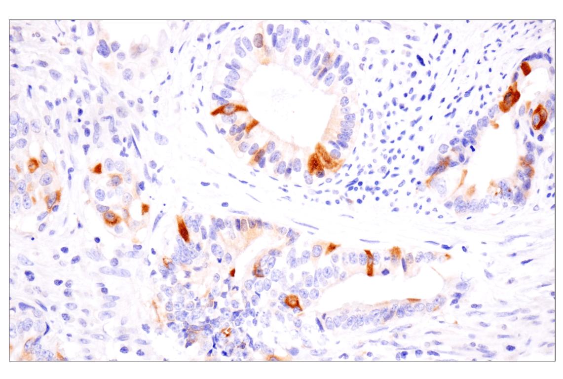 Immunohistochemistry Image 5: Cyclin B1 (F7U1O) Rabbit Monoclonal Antibody