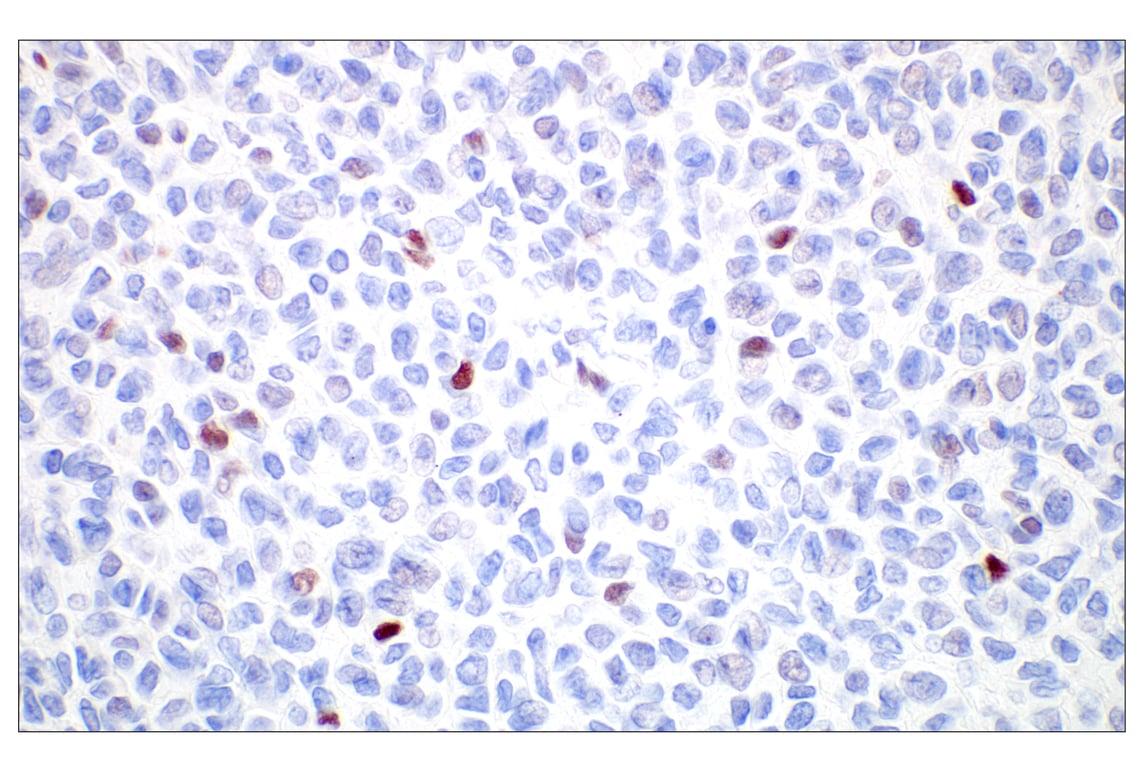 Immunohistochemistry Image 2: GATA-2 (E8B5C) Rabbit Monoclonal Antibody