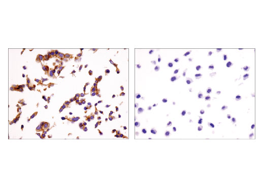 Immunohistochemistry Image 3: LSR (D3E3N) Rabbit Monoclonal Antibody