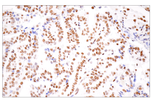 Immunohistochemistry Image 3: CPSF4 (E2L2Z) Rabbit Monoclonal Antibody