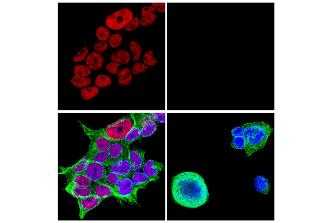 Immunofluorescence Image 1: TDP43 (D9R3L) Rabbit Monoclonal Antibody (Alexa Fluor<sup>®</sup> 555 Conjugate)