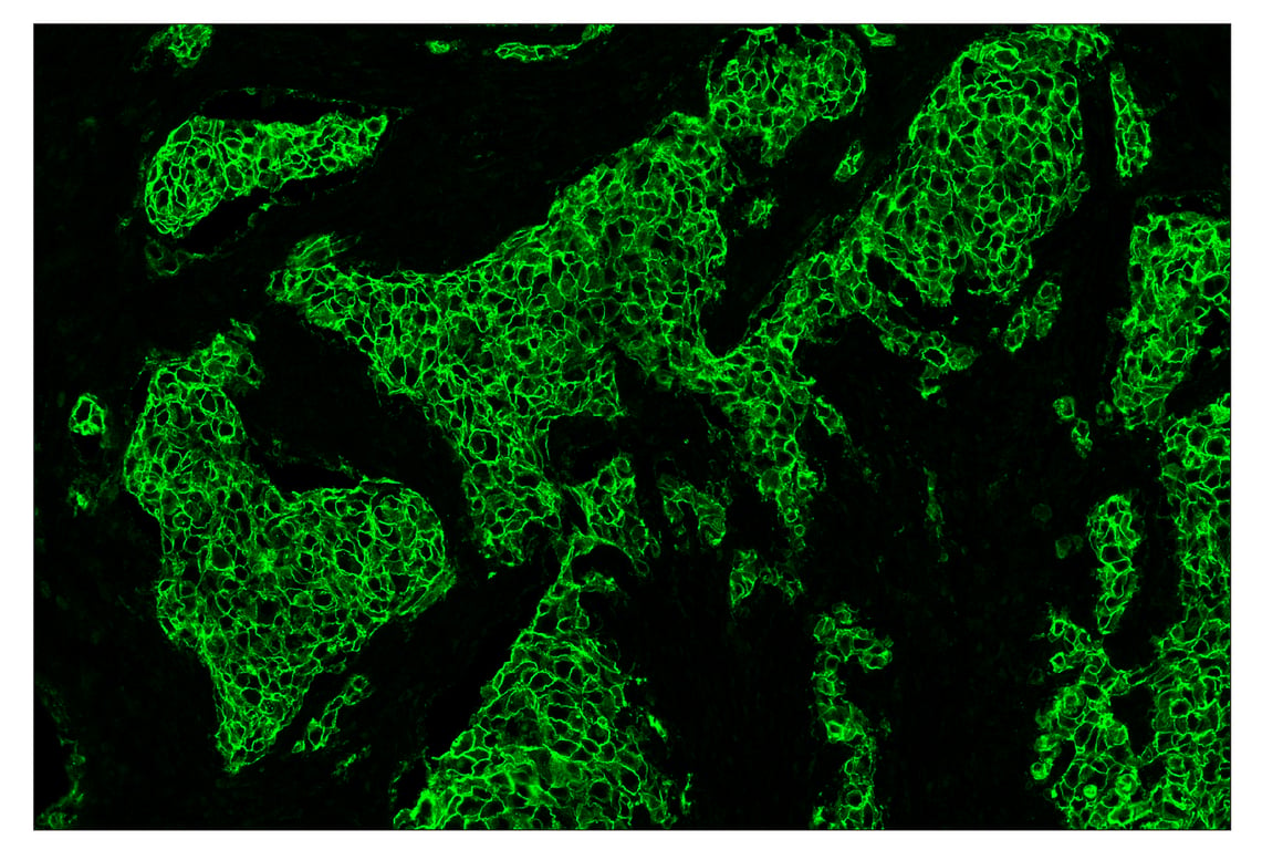 Immunohistochemistry Image 2: HER2/ErbB2 (D8F12) & CO-0019-488 SignalStar<sup>™</sup> Oligo-Antibody Pair