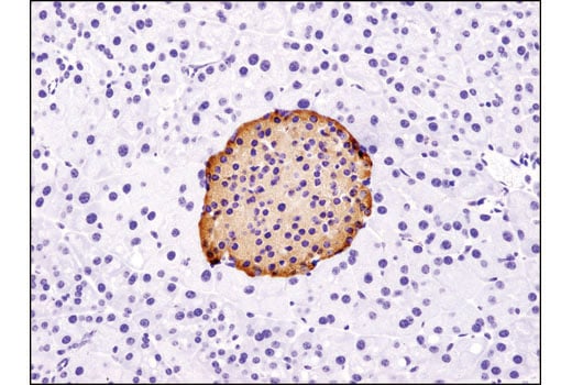 Immunohistochemistry Image 1: PC2 (D1E1S) XP<sup>®</sup> Rabbit mAb (BSA and Azide Free)