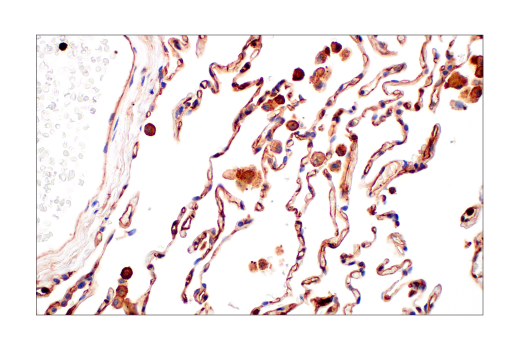 Immunohistochemistry Image 9: Phospho-Tyrosine Mouse Monoclonal Antibody (P-Tyr-100) (BSA and Azide Free)