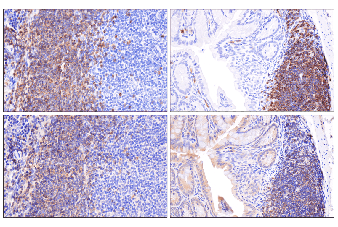 Immunohistochemistry Image 7: CD79A (F3Z1H) Rabbit Monoclonal Antibody