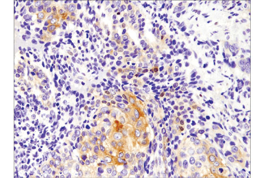 Immunohistochemistry Image 1: FoxO1 (D8T1S) Mouse Monoclonal Antibody