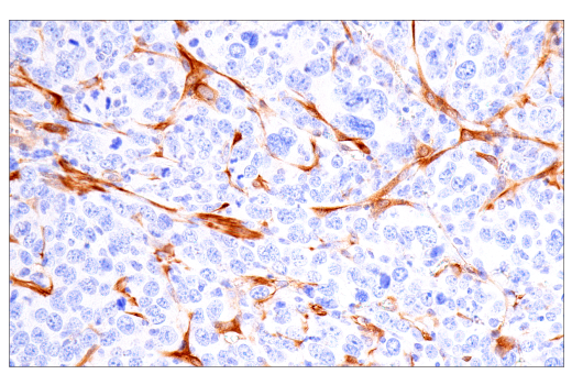 Immunohistochemistry Image 10: CRP2 (E8R5N) Rabbit Monoclonal Antibody