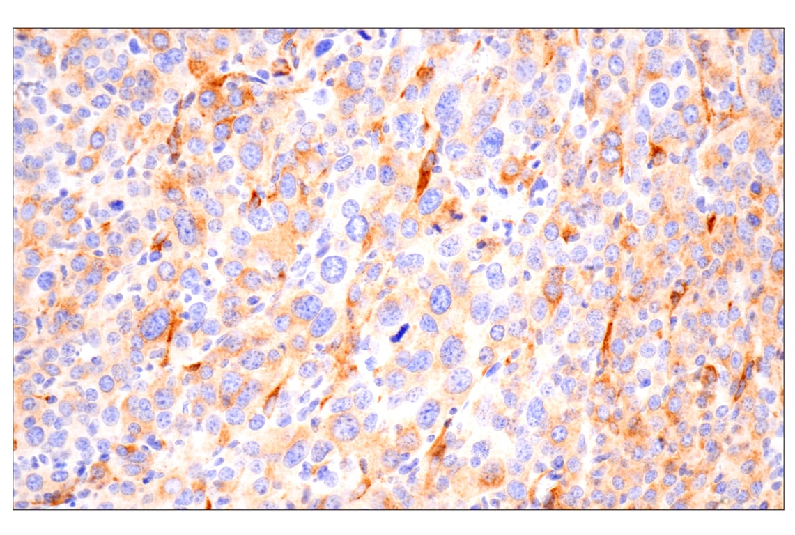 Immunohistochemistry Image 1: Cathepsin K (E7U5N) Rabbit Monoclonal Antibody (BSA and Azide Free)