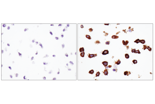 Immunohistochemistry Image 5: MX1 (D3W7I) Rabbit Monoclonal Antibody (BSA and Azide Free)