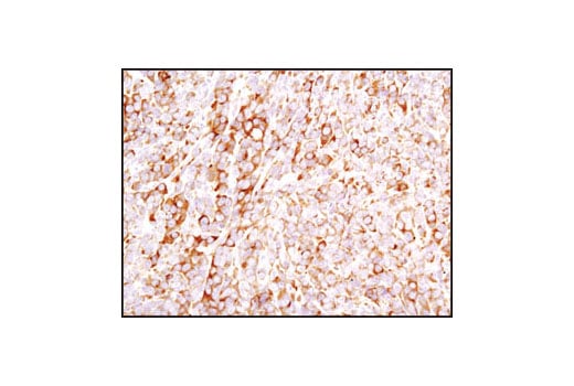 Immunohistochemistry Image 1: Ezrin Antibody