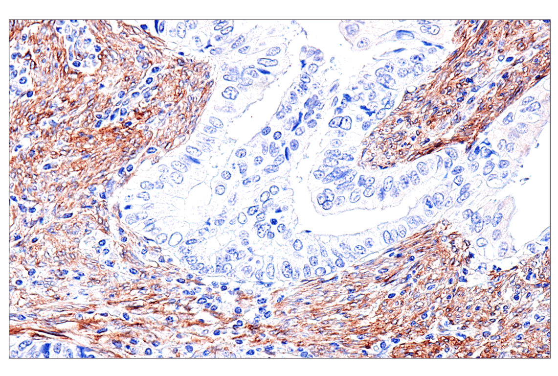 Immunohistochemistry Image 2: FAP (F1A4G) Rabbit Monoclonal Antibody