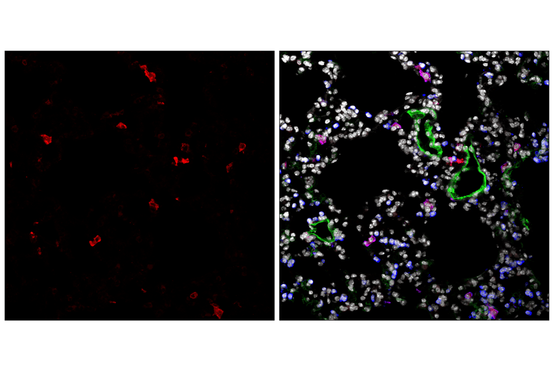Immunofluorescence Image 3: CD11c (D1V9Y) Rabbit Monoclonal Antibody (Alexa Fluor<sup>®</sup> 555 Conjugate)