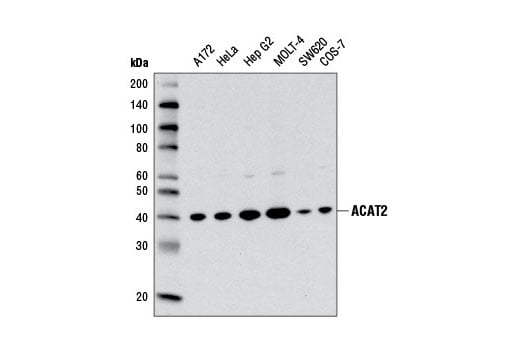 Western Blotting Image 1: ACAT2 (E1L8V) Rabbit mAb