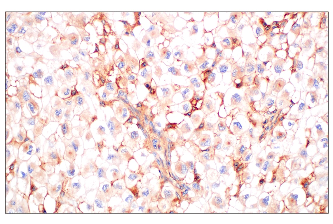 Immunohistochemistry Image 6: CD58 (F1C9B) Rabbit Monoclonal Antibody