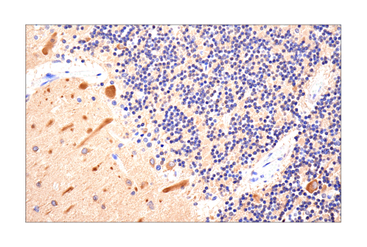 Immunohistochemistry Image 6: LC3B (E5Q2K) Mouse Monoclonal Antibody (BSA and Azide Free)