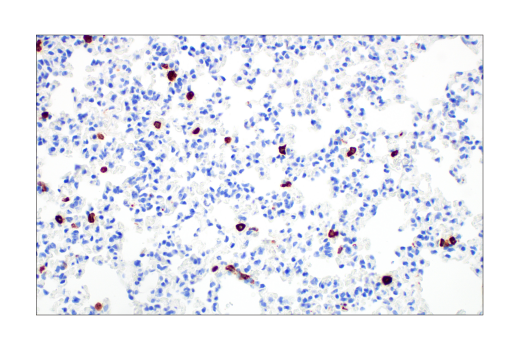 Immunohistochemistry Image 2: CD206/MRC1 (E6T5J) Rabbit Monoclonal Antibody (BSA and Azide Free)