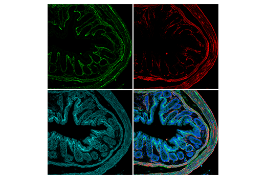 Immunofluorescence Image 3: COL1A1 (E8F4L) Rabbit Monoclonal Antibody (Alexa Fluor<sup>®</sup> 488 Conjugate)