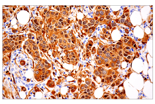 Immunohistochemistry Image 2: YAP/TAZ (E9M8G) Rabbit Monoclonal Antibody (BSA and Azide Free)