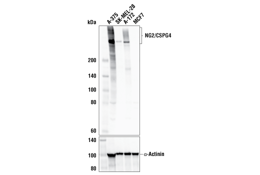 Western Blotting Image 3: NG2/CSPG4 (E3B3G) Rabbit Monoclonal Antibody (BSA and Azide Free)