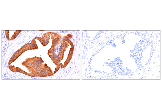 Immunohistochemistry Image 7: TIMP1 (D10E6) Rabbit Monoclonal Antibody