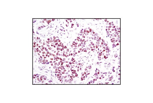 Immunohistochemistry Image 1: Progesterone Receptor A/B (C89F7) Rabbit Monoclonal Antibody