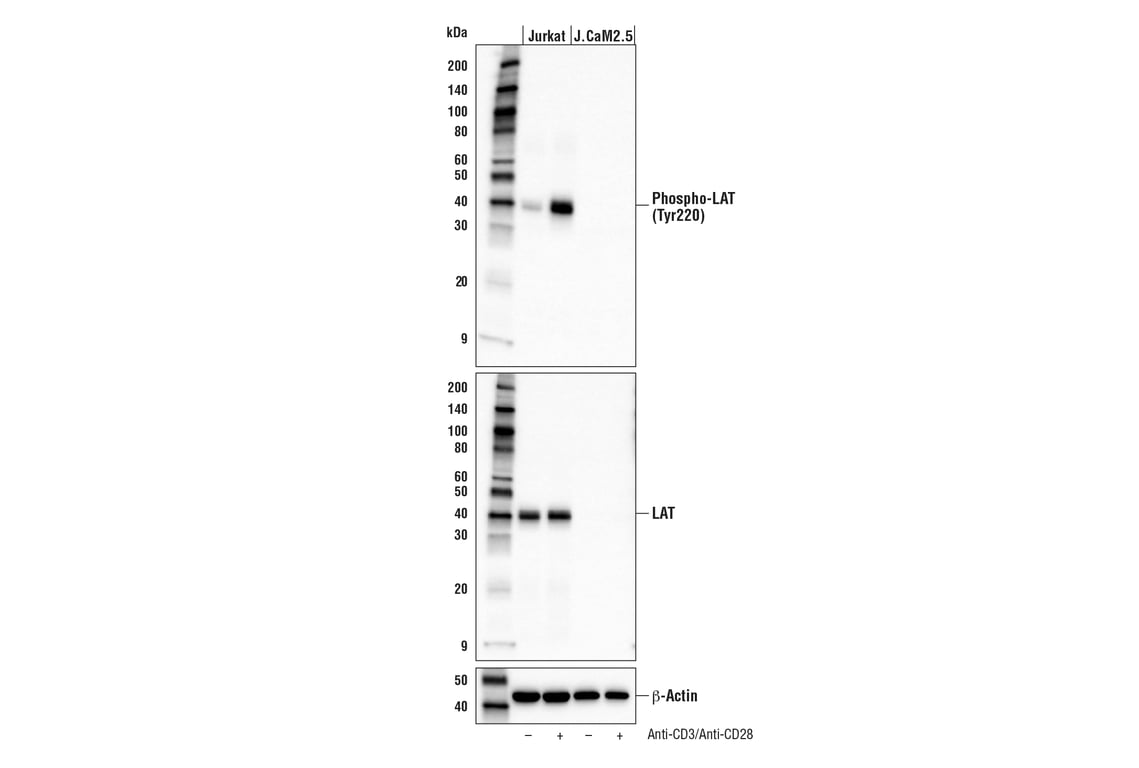Western Blotting Image 2: Phospho-LAT (Tyr220) (E3S5L) Rabbit Monoclonal Antibody (BSA and Azide Free)