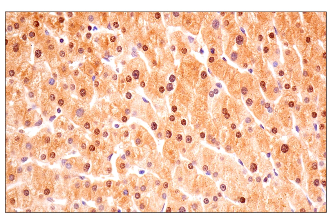 Immunohistochemistry Image 11: ACBP/DBI (E6K8G) XP<sup>®</sup> Rabbit mAb