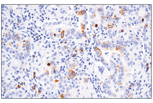 Immunohistochemistry Image 3: RHAMM/CD168 (E7S4Y) Rabbit Monoclonal Antibody