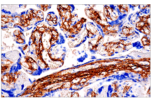 Immunohistochemistry Image 1: COL1A1 (E3E1X) Mouse Monoclonal Antibody
