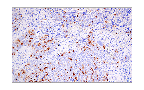 Immunohistochemistry Image 7: Geminin (E5Q9S) XP<sup>®</sup> Rabbit mAb (BSA and Azide Free)