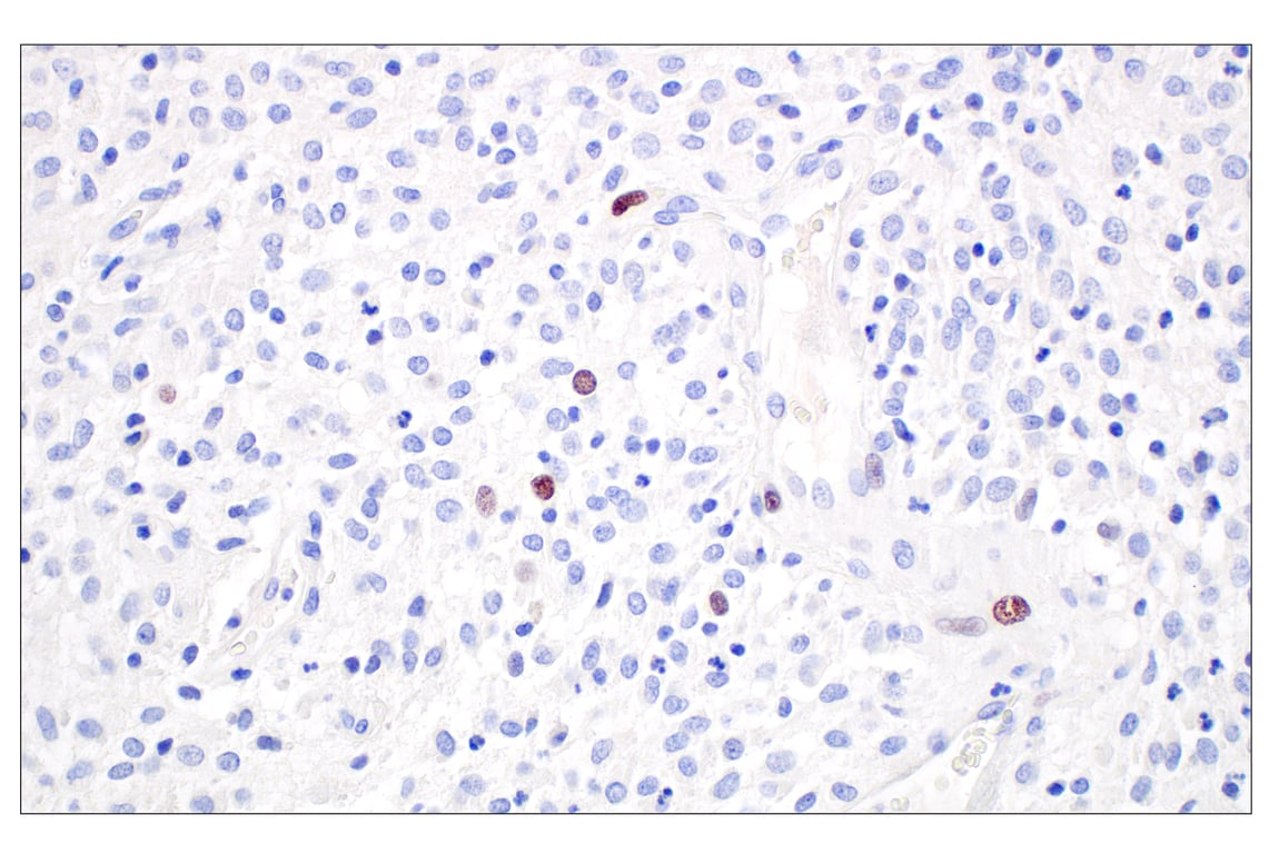 Immunohistochemistry Image 3: SGO2 (E9K4N) Rabbit Monoclonal Antibody (BSA and Azide Free)