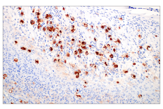 Immunohistochemistry Image 4: 4-1BB/CD137/TNFRSF9 (E2J5H) Rabbit Monoclonal Antibody