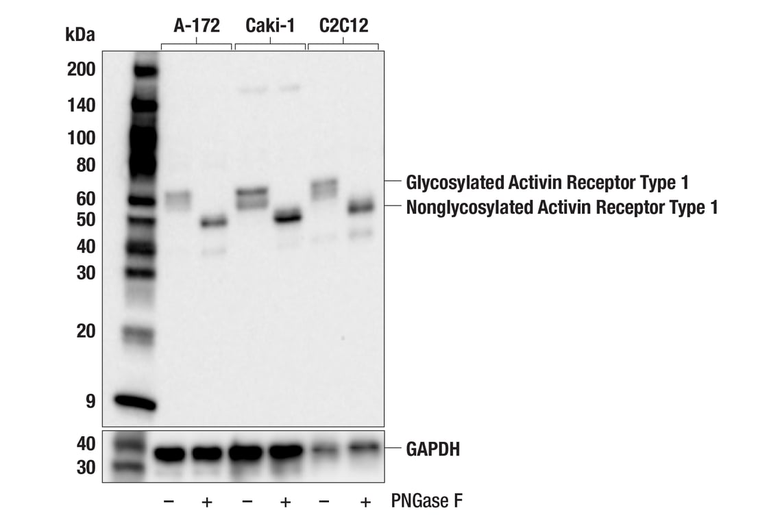 Activin Receptor Type 1 (F6M1E) Rabbit Monoclonal Antibody | Cell