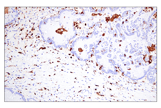 Immunohistochemistry Image 7: Iba1/AIF-1 (E4O4W) Rabbit Monoclonal Antibody (BSA and Azide Free)