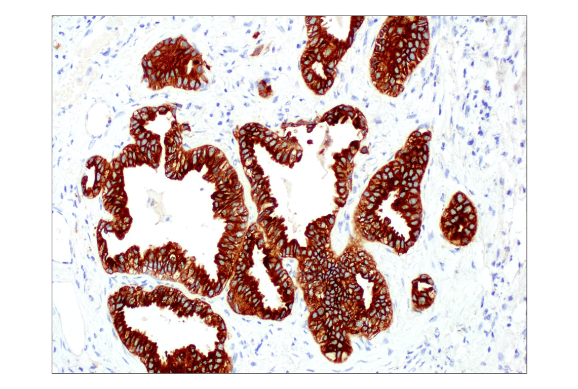 Immunohistochemistry Image 1: ALK (D5F3) Rabbit Monoclonal Antibody