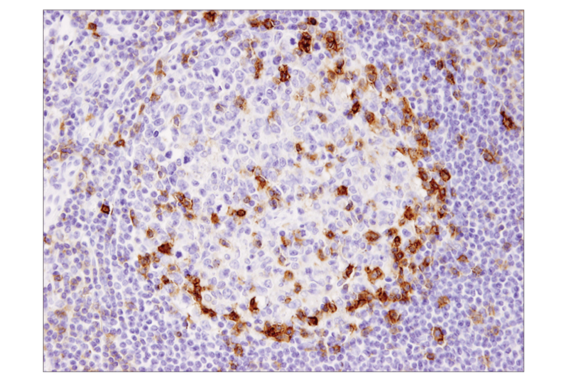 Immunohistochemistry Image 4: ICOS (D1K2T) Rabbit Monoclonal Antibody