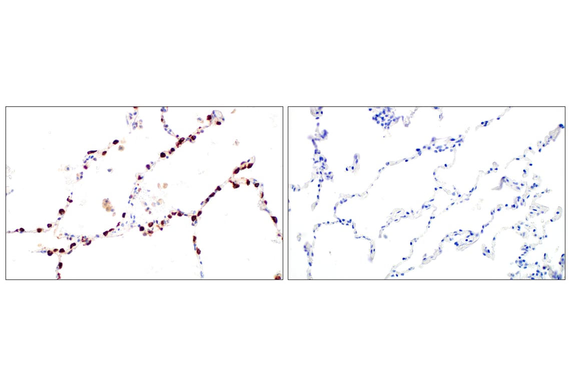 Immunohistochemistry Image 6: LPCAT1 (E4V4B) Rabbit Monoclonal Antibody (BSA and Azide Free)