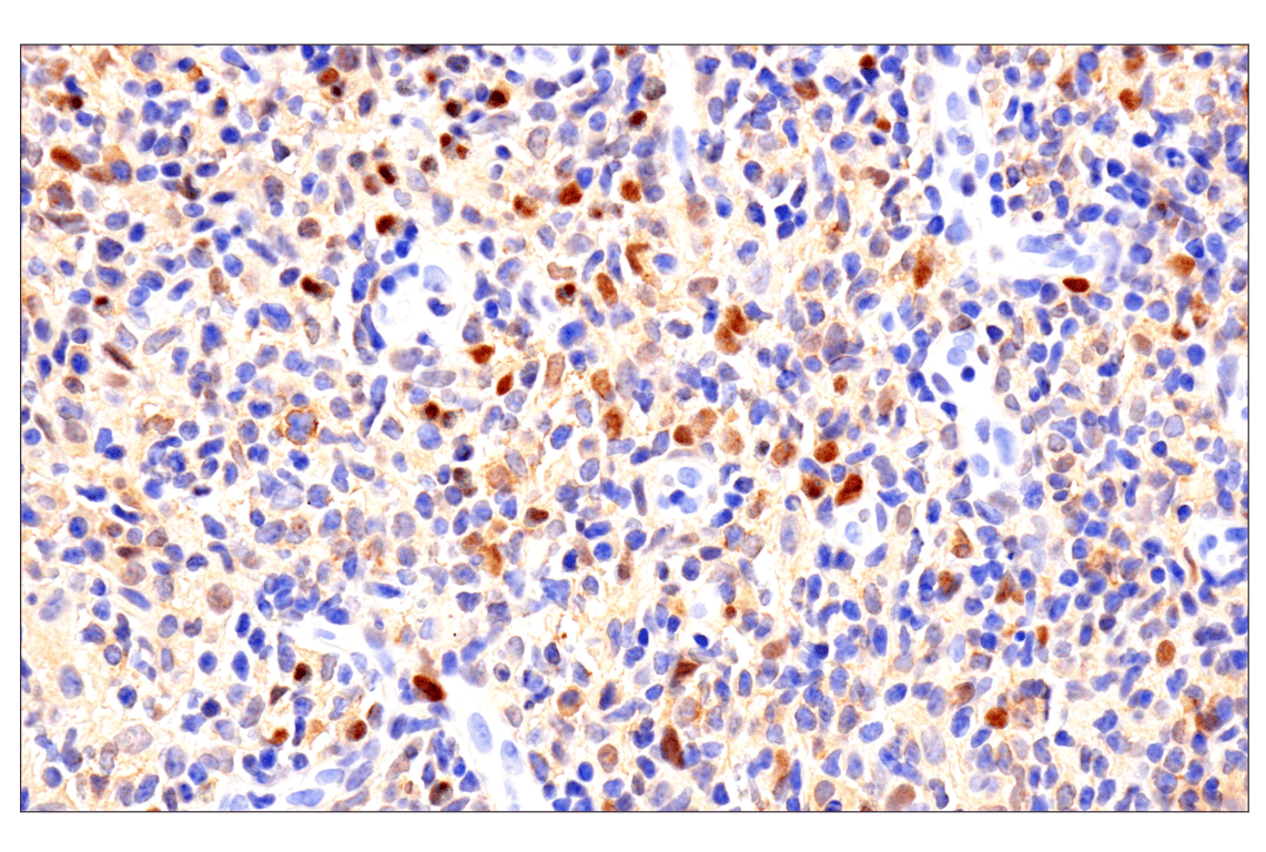 Immunohistochemistry Image 1: Notch2 (D76A6) Rabbit Monoclonal Antibody