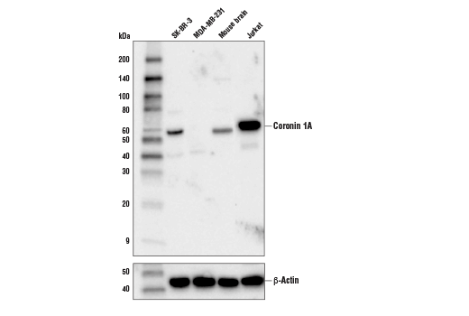 Western Blotting Image 1: Coronin 1A (D6K5B) XP<sup>®</sup> Rabbit mAb