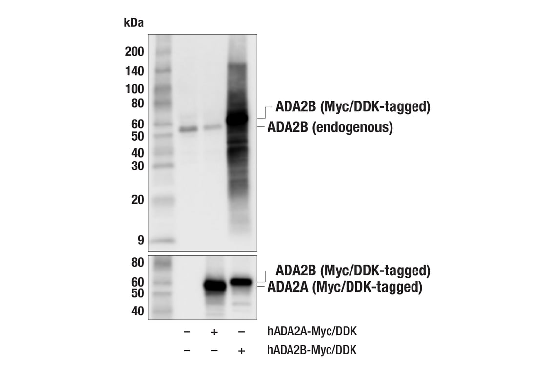 Western Blotting Image 3: ADA2B (F6G5T) Rabbit Monoclonal Antibody