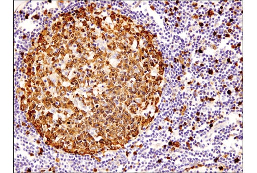 Immunohistochemistry Image 4: Stathmin (D1Y5A) Rabbit Monoclonal Antibody