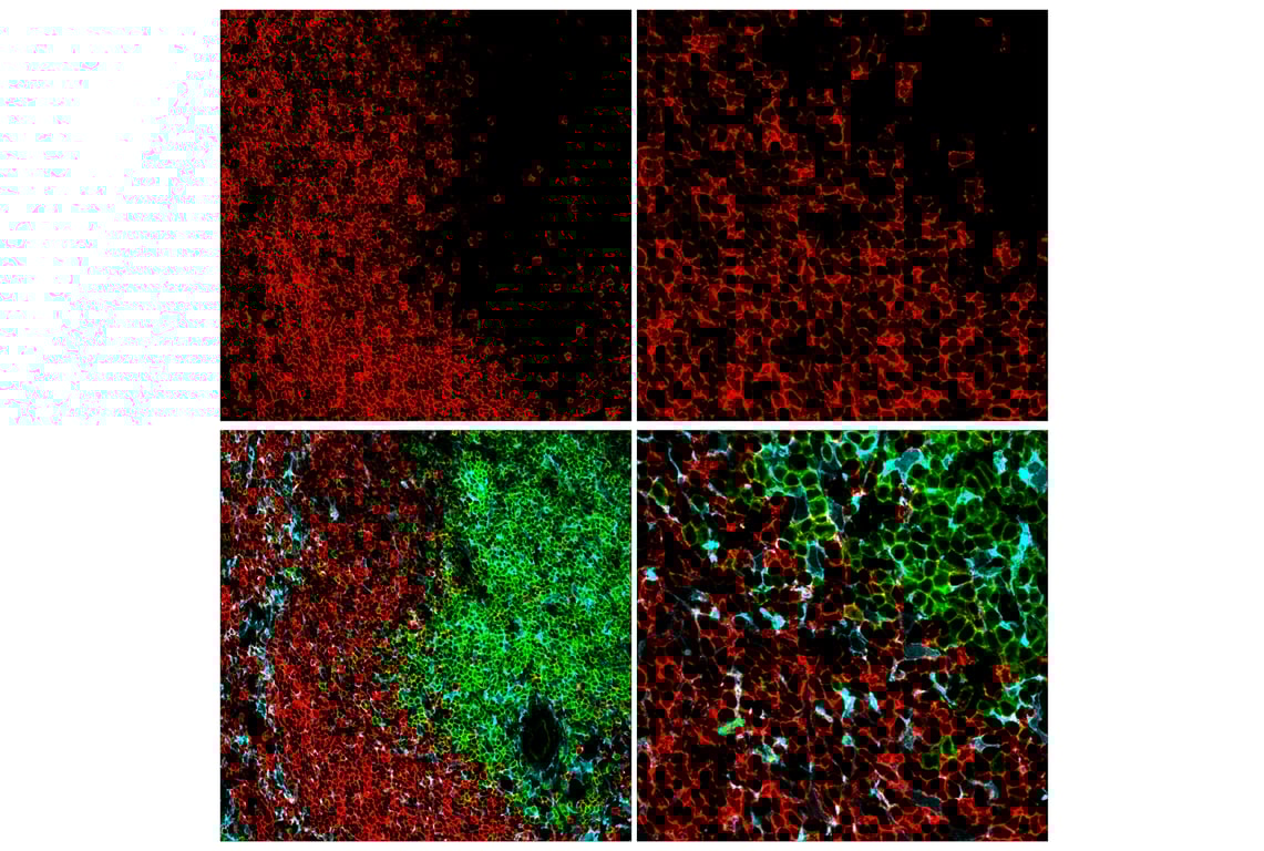 Immunofluorescence Image 2: CD20 (E3N7O) Rabbit Monoclonal Antibody