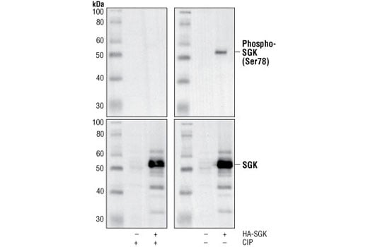 Western Blotting Image 1: Phospho-SGK (Ser78) Antibody