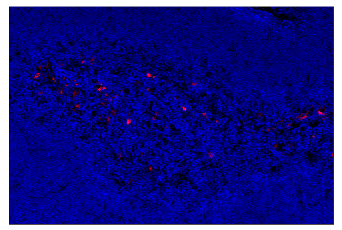 Immunohistochemistry Image 4: iNOS (E1W4J) & CO-0179-488 SignalStar<sup>™</sup> Oligo-Antibody Pair