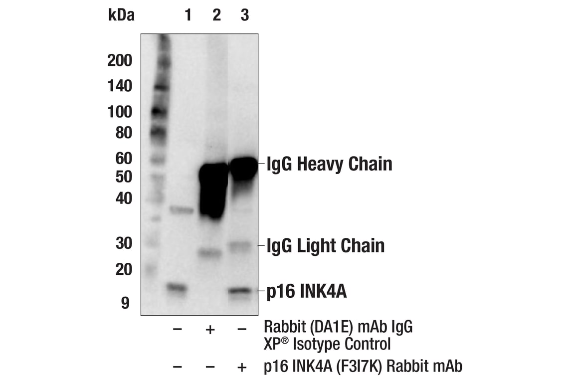 Immunoprecipitation Image 1: p16 INK4A (F3I7K) Rabbit Monoclonal Antibody