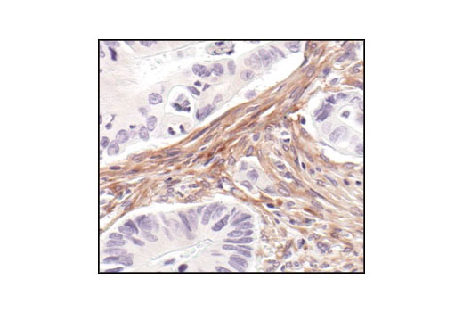 Immunohistochemistry Image 2: PDGF Receptor β (28E1) Rabbit mAb (BSA and Azide Free)