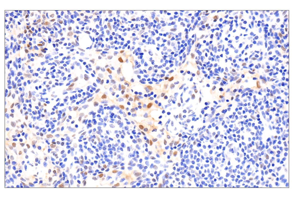 Immunohistochemistry Image 7: Phospho-Stat3 (Ser727) (D4X3C) Rabbit Monoclonal Antibody
