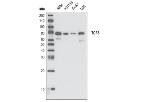 Western Blotting Image 1: TCF3/TCF7L1 (D15G11) Rabbit mAb